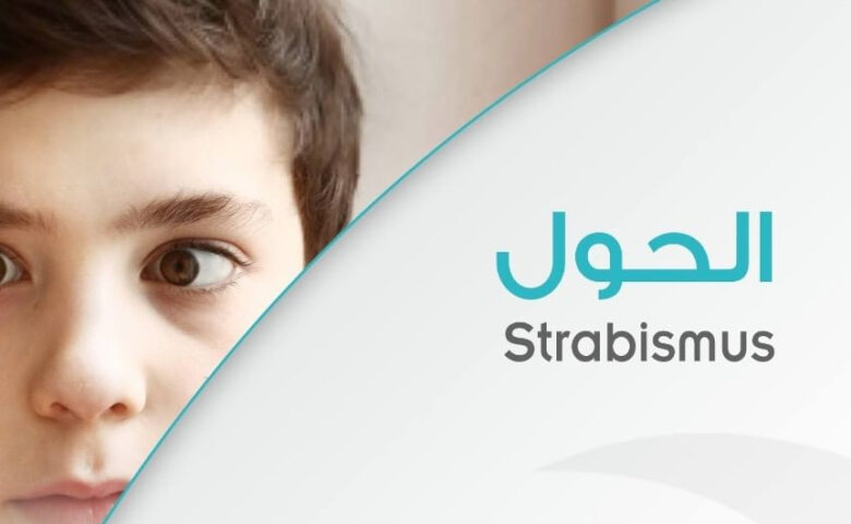 strabismus strabismus
